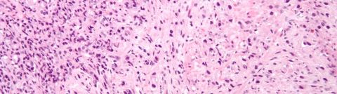 Dr. Douglas McNeel Co-Authors Guidelines for Prostate Cancer Immunotherapy